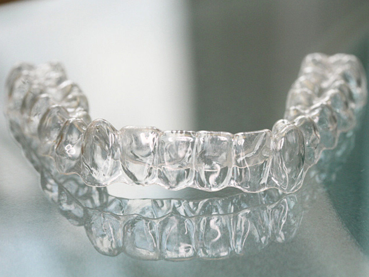 Invisalign Unsichtbare Zahnspange