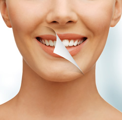 Bleaching Zahnaufhellung Orthodentix