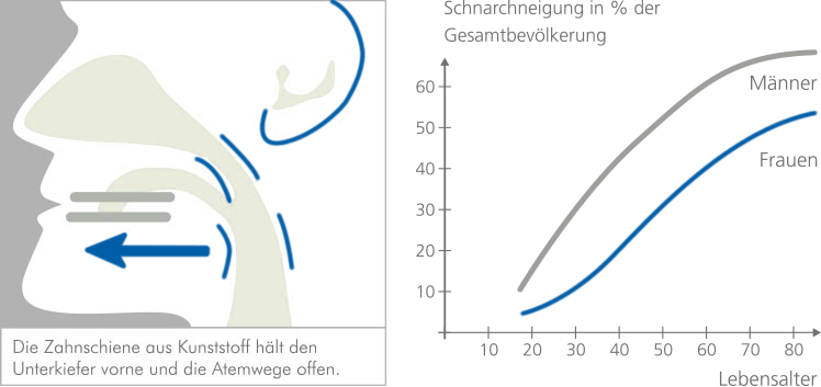 Grafik Was Ist Schnarchen Orthodentix