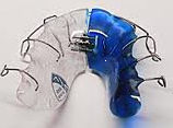 Herausnehmbare Spangen Orthodentix