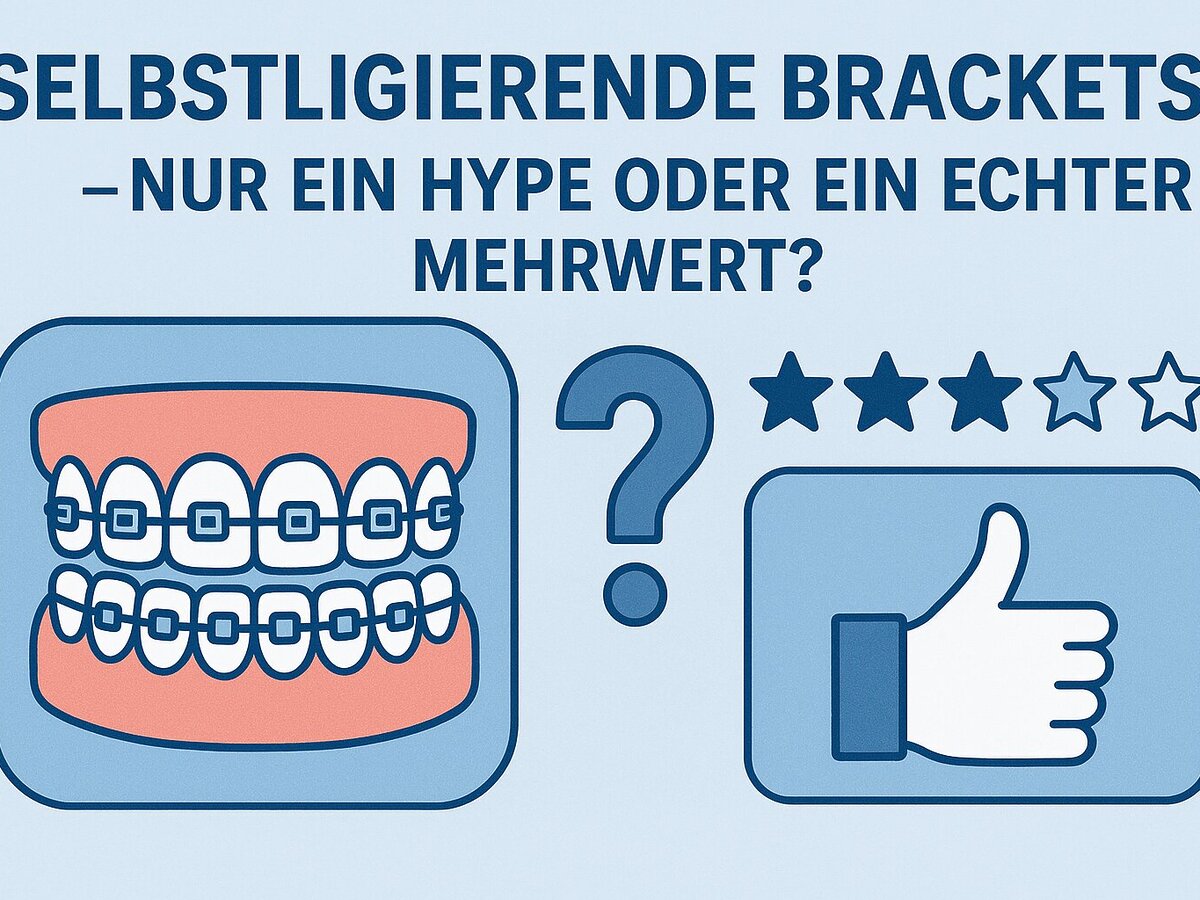 Selbstligierende Brackets
