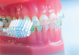 Zahnbuerste Auf Brackets Orthodentix